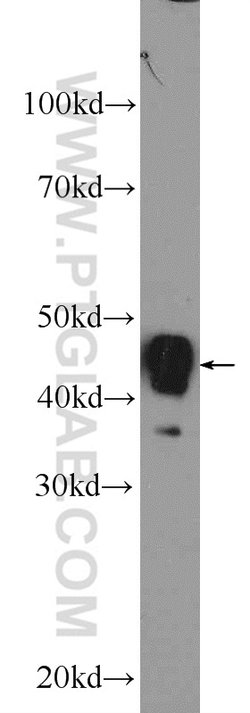 ACADM Rabbit anti-Human, Mouse, Rat, Polyclonal, Proteintech:Antibodies:Primary