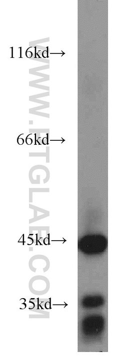 ACADM Rabbit anti-Human, Mouse, Rat, Polyclonal, Proteintech:Antibodies:Primary