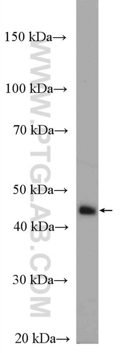 ACADM Rabbit anti-Human, Mouse, Rat, Polyclonal, Proteintech:Antibodies:Primary