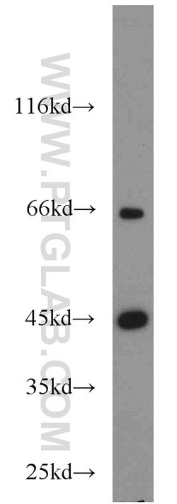 ACADM Rabbit anti-Human, Mouse, Rat, Polyclonal, Proteintech:Antibodies:Primary