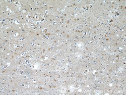 CaMKII beta Rabbit anti-Human, Mouse, Rat, Polyclonal, Proteintech 150 &mu;L | Buy Online | Proteintech Group Inc | Fisher Scientific