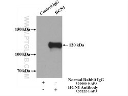 HCN1 Rabbit anti-Human, Mouse, Rat, Polyclonal, Proteintech 150 &mu;L | Buy Online | Proteintech Group Inc | Fisher Scientific