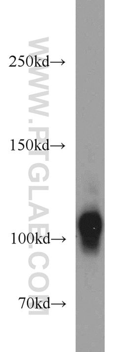 HCN1 Rabbit anti-Human, Mouse, Rat, Polyclonal, Proteintech 150 &mu;L | Buy Online | Proteintech Group Inc | Fisher Scientific