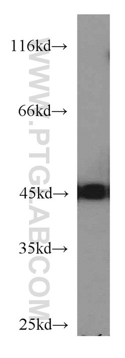 NSE/ENO2 Rabbit anti-Human, Mouse, Rat, Polyclonal, Proteintech:Antibodies:Primary