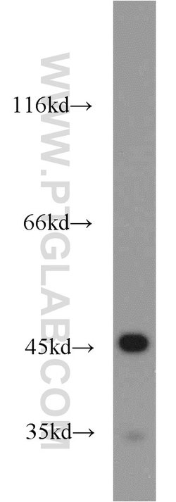 NSE/ENO2 Rabbit anti-Human, Mouse, Rat, Polyclonal, Proteintech:Antibodies:Primary