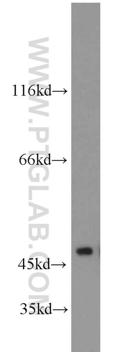 NSE/ENO2 Rabbit anti-Human, Mouse, Rat, Polyclonal, Proteintech:Antibodies:Primary