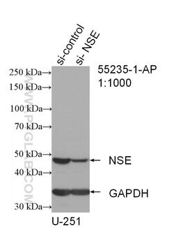 NSE/ENO2 Rabbit anti-Human, Mouse, Rat, Polyclonal, Proteintech:Antibodies:Primary