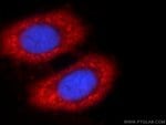 Thumbnail_ENO1 Rabbit anti-Human, Mouse, Rat, Polyclonal, Proteintech:Antibodies:Primary