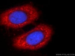 Proteintech ENO1 Rabbit anti-Human, Mouse, Rat, Polyclonal, Proteintech