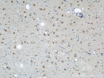 Thumbnail_ENO1 Rabbit anti-Human, Mouse, Rat, Polyclonal, Proteintech:Antibodies:Primary