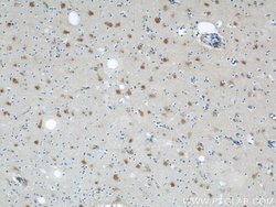 ENO1 Rabbit anti-Human, Mouse, Rat, Polyclonal, Proteintech:Antibodies:Primary