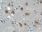 Thumbnail_ENO1 Rabbit anti-Human, Mouse, Rat, Polyclonal, Proteintech:Antibodies:Primary