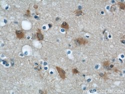 ENO1 Rabbit anti-Human, Mouse, Rat, Polyclonal, Proteintech:Antibodies:Primary