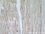 Thumbnail_ENO1 Rabbit anti-Human, Mouse, Rat, Polyclonal, Proteintech:Antibodies:Primary