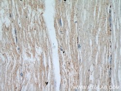 ENO1 Rabbit anti-Human, Mouse, Rat, Polyclonal, Proteintech:Antibodies:Primary
