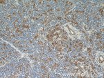 Thumbnail_ENO1 Rabbit anti-Human, Mouse, Rat, Polyclonal, Proteintech:Antibodies:Primary
