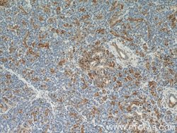 ENO1 Rabbit anti-Human, Mouse, Rat, Polyclonal, Proteintech:Antibodies:Primary