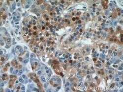 ENO1 Rabbit anti-Human, Mouse, Rat, Polyclonal, Proteintech:Antibodies:Primary