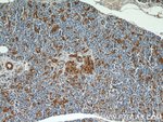 Thumbnail_ENO1 Rabbit anti-Human, Mouse, Rat, Polyclonal, Proteintech:Antibodies:Primary
