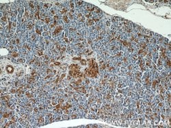 ENO1 Rabbit anti-Human, Mouse, Rat, Polyclonal, Proteintech:Antibodies:Primary