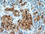 Thumbnail_ENO1 Rabbit anti-Human, Mouse, Rat, Polyclonal, Proteintech:Antibodies:Primary