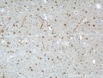 Thumbnail_ENO1 Rabbit anti-Human, Mouse, Rat, Polyclonal, Proteintech:Antibodies:Primary
