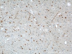 ENO1 Rabbit anti-Human, Mouse, Rat, Polyclonal, Proteintech:Antibodies:Primary