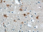 Thumbnail_ENO1 Rabbit anti-Human, Mouse, Rat, Polyclonal, Proteintech:Antibodies:Primary