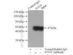 Thumbnail_ENO1 Rabbit anti-Human, Mouse, Rat, Polyclonal, Proteintech:Antibodies:Primary