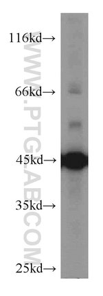 Thumbnail_ENO1 Rabbit anti-Human, Mouse, Rat, Polyclonal, Proteintech:Antibodies:Primary