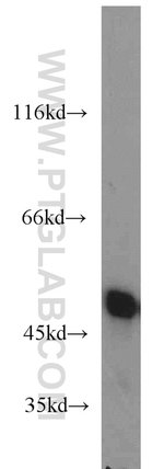 Thumbnail_ENO1 Rabbit anti-Human, Mouse, Rat, Polyclonal, Proteintech:Antibodies:Primary