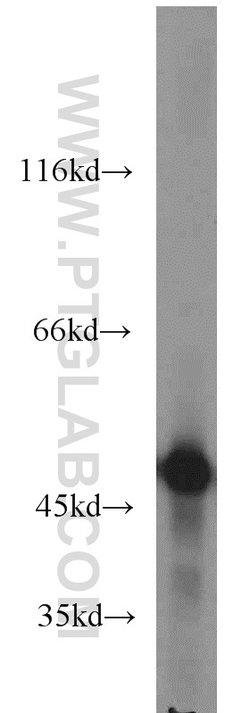 ENO1 Rabbit anti-Human, Mouse, Rat, Polyclonal, Proteintech:Antibodies:Primary