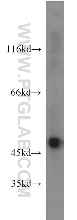 ENO1 Rabbit anti-Human, Mouse, Rat, Polyclonal, Proteintech:Antibodies:Primary