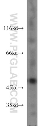 Thumbnail_ENO1 Rabbit anti-Human, Mouse, Rat, Polyclonal, Proteintech:Antibodies:Primary