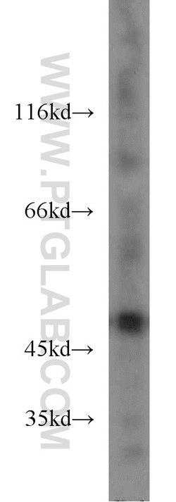 ENO1 Rabbit anti-Human, Mouse, Rat, Polyclonal, Proteintech:Antibodies:Primary
