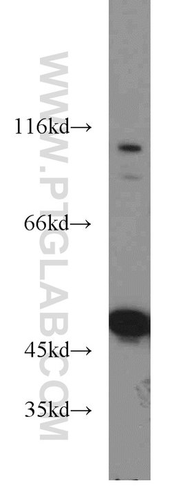 ENO1 Rabbit anti-Human, Mouse, Rat, Polyclonal, Proteintech:Antibodies:Primary