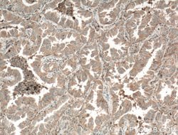 TPSD1 Rabbit anti-Human, Mouse, Polyclonal, Proteintech 150 &mu;L; Unconjugated:Antibodies,