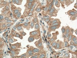 TPSD1 Rabbit anti-Human, Mouse, Polyclonal, Proteintech 150 &mu;L; Unconjugated:Antibodies,