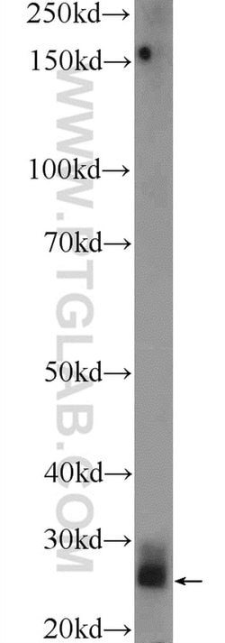 TPSD1 Rabbit anti-Human, Mouse, Polyclonal, Proteintech 150 &mu;L; Unconjugated:Antibodies,