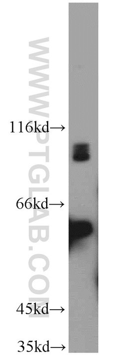 MAP4K2 Rabbit anti-Human, Mouse, Rat, Polyclonal, Proteintech:Antibodies:Primary