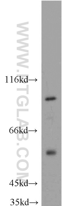 MAP4K2 Rabbit anti-Human, Mouse, Rat, Polyclonal, Proteintech:Antibodies:Primary