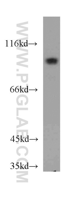 MAP4K2 Rabbit anti-Human, Mouse, Rat, Polyclonal, Proteintech:Antibodies:Primary