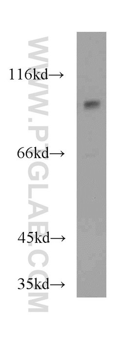 MAP4K2 Rabbit anti-Human, Mouse, Rat, Polyclonal, Proteintech:Antibodies:Primary