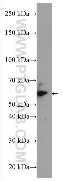 CARM1 Rabbit anti-Human, Mouse, Non-human primate, Rat, Polyclonal, Proteintech:Antibodies:Primary