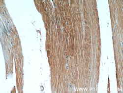 MAP4K4 Rabbit anti-Human, Mouse, Rat, Polyclonal, Proteintech 150 &mu;L;