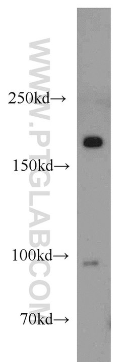 MAP4K4 Rabbit anti-Human, Mouse, Rat, Polyclonal, Proteintech 150 &mu;L;