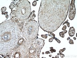 MAP4K4 Rabbit anti-Human, Mouse, Rat, Polyclonal, Proteintech 150 &mu;L;