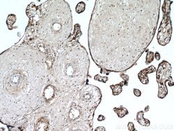 MAP4K4 Rabbit anti-Human, Mouse, Rat, Polyclonal, Proteintech 150 &mu;L;
