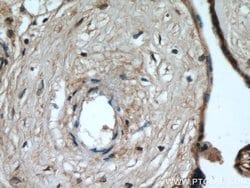 MAP4K4 Rabbit anti-Human, Mouse, Rat, Polyclonal, Proteintech 150 &mu;L;