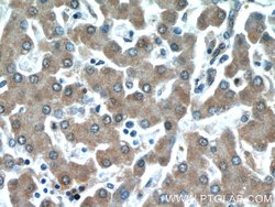 MAP4K4 Rabbit anti-Human, Mouse, Rat, Polyclonal, Proteintech 150 &mu;L;